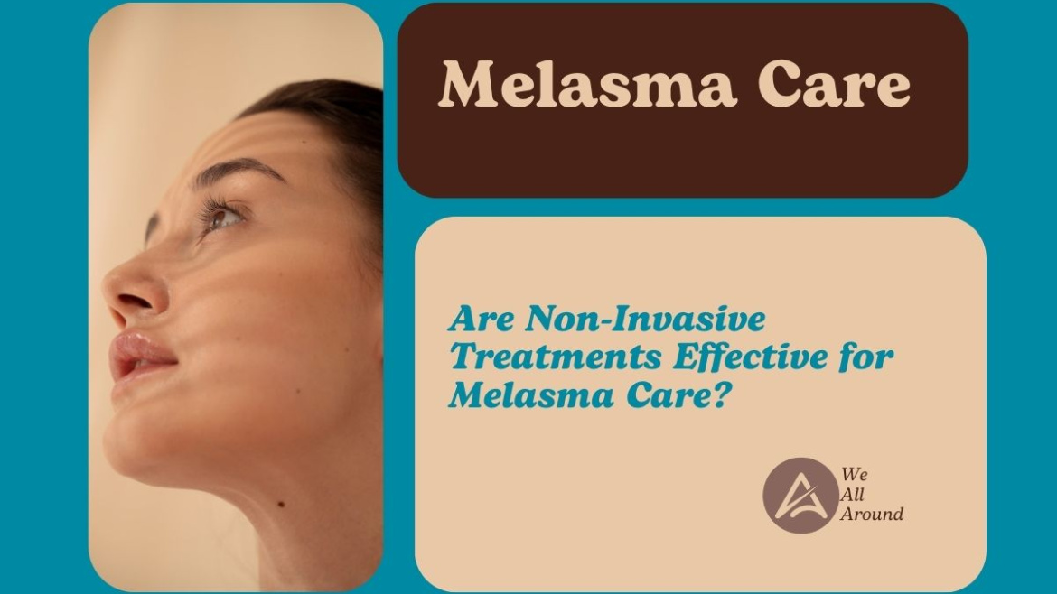 Melasma Care