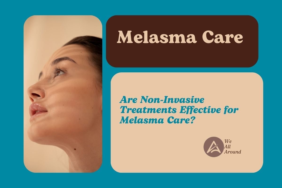 Melasma Care